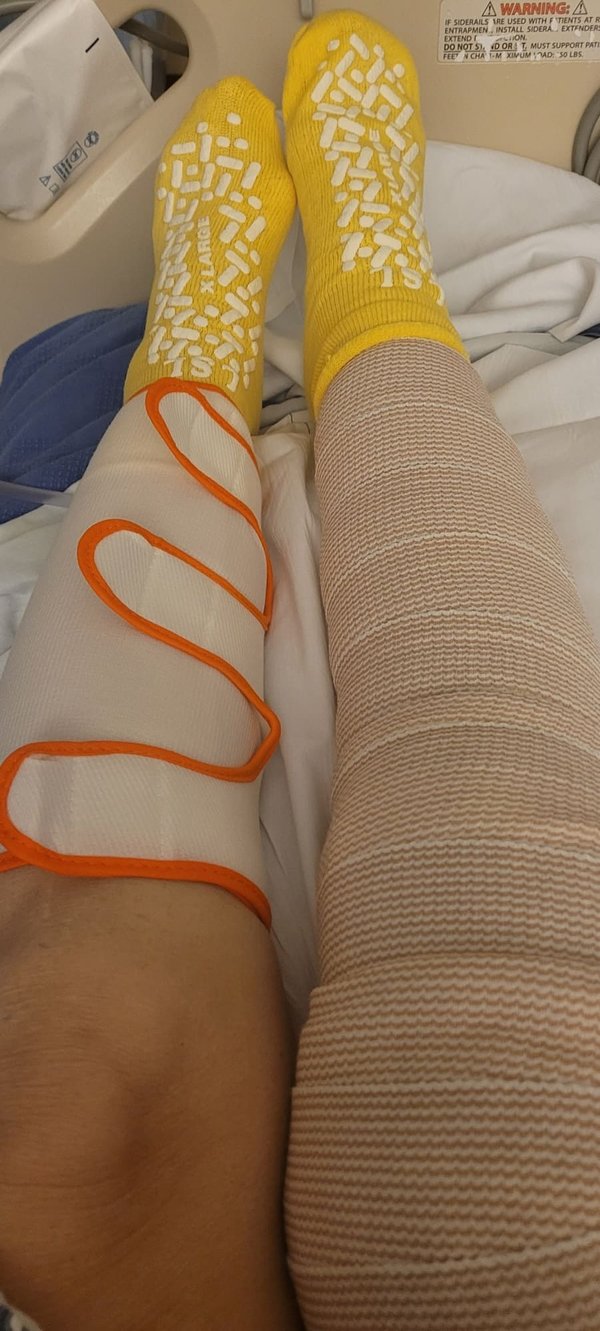 Les meilleurs choix de bas et chaussettes de compression médicale pour votre santé